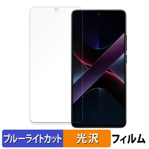 Xiaomi POCO X7 Pro  یtB u[CgJbg tB ydlz {