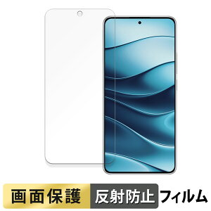 Xiaomi Redmi Note 14 5G  tB y˒ጸz t یtB {