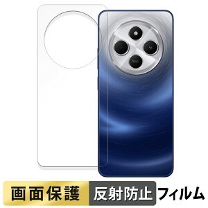 Xiaomi Redmi 14C ( w )  tB y˒ጸz t یtB {