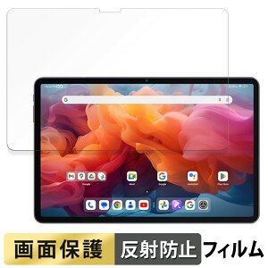 ALLDOCUBE iPlay 60 Pad Pro (  ) tB t یtB y ˒ጸ z {