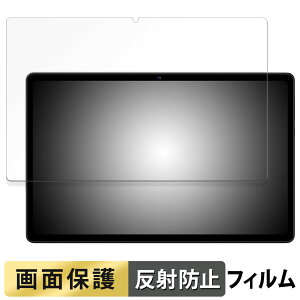 AvidPad S60 / S60-15 �t�B���� �t�� �ی�t�B���� �y ���˒ጸ �z ���{��