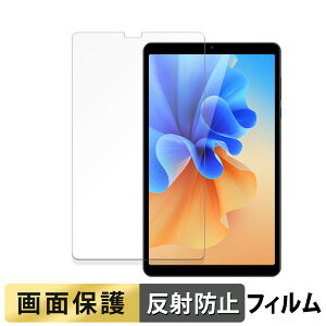 AvidPad S30 ������ �t�B���� �t�� �ی�t�B���� �y���˒ጸ�z ���{��