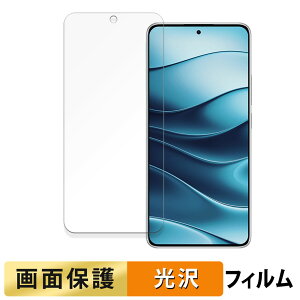 Xiaomi Redmi Note 14 5G  tB yߗz t یtB {