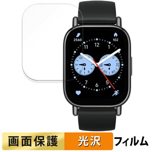 y|Cg2{z Xiaomi Redmi Watch 5 Lite p tB t یtB yߗz VI~ bh~[ EHb` 5 Cg