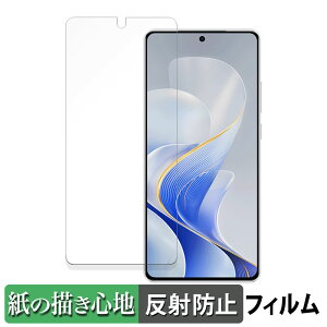 vivo S19  y[p[CN tB ŷ悤ȏSnz t یtB ˒ጸ {