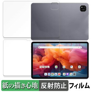 y|Cg2{z ALLDOCUBE iPlay 60 Pad Pro tEw Zbg  y[p[CN tB ŷ悤ȏSnz t یtB ˒ጸ {
