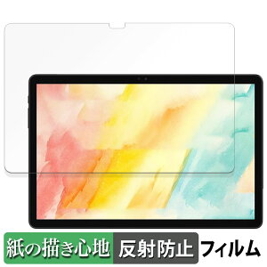 ALLDOCUBE iPlay 60S / iPlay 60S 4G (  )  y[p[CN tB ŷ悤ȏSnz t یtB ˒ጸ {
