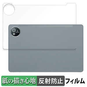 AvidPad S60 ( w )  y[p[CN tB ŷ悤ȏSnz t یtB ˒ጸ {