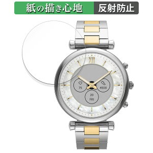 FOSSIL CARLIE WFl[V6 nCubh X}[gEHb` P[XTCY 41mm p y[p[CN tB ŷ悤ȏSnz t یtB ˒ጸ {