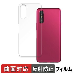 y|Cg2{z 炭炭X}[gtH a A401FC / 炭炭X}[gtH Lite MR01 ( w )  یtB yȖʑΉ ˒ጸz LYC {