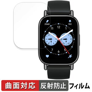 Xiaomi Redmi Watch 5 Lite �p �ی�t�B���� �y�ȖʑΉ� ���˒ጸ�z �L�Y�C�� �V���I�~ ���b�h�~�[ �E�H�b�` 5 ���C�g