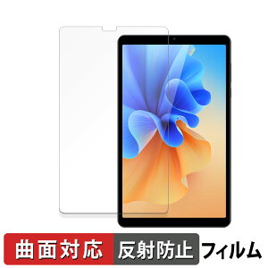 AvidPad S30  یtB yȖʑΉ ˒ጸz LYC {