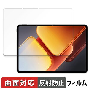 vivo iQOO Pad2 Pro ������ �ی�t�B���� �y�ȖʑΉ� ���˒ጸ�z �L�Y�C�� ���{��