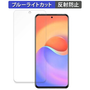 ZTE S30 Pro ������ �ی�t�B���� �u���[���C�g�J�b�g �t�B���� �y�ȖʑΉ� ���˒ጸ�z �L�Y�C�� ���{��