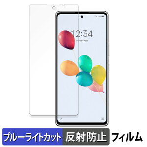 ZTE 񂵂t@~[X}z  یtB u[CgJbg tB yȖʑΉ ˒ጸz LYC {