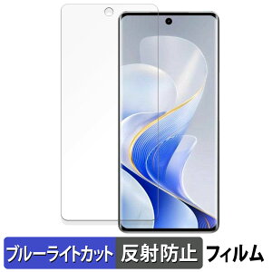 vivo S19 Pro  یtB u[CgJbg tB yȖʑΉ ˒ጸz LYC {