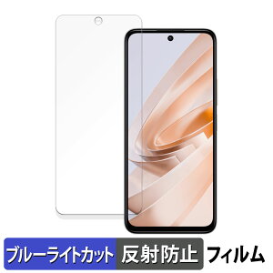 y|Cg2{z Xiaomi Redmi Note 13R 5G  یtB u[CgJbg tB yȖʑΉ ˒ጸz LYC {
