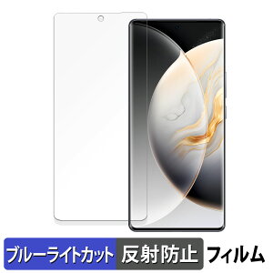 TECNO CAMON 30S Pro ������ �ی�t�B���� �u���[���C�g�J�b�g �t�B���� �y�ȖʑΉ� ���˒ጸ�z �L�Y�C�� ���{��