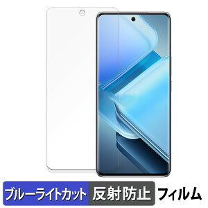 vivo iQOO Z9s Pro  یtB u[CgJbg tB yȖʑΉ ˒ጸz LYC {