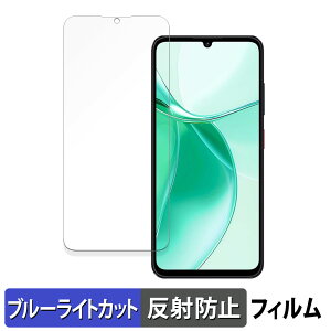 ZTE Blade A35 ������ �ی�t�B���� �u���[���C�g�J�b�g �t�B���� �y�ȖʑΉ� ���˒ጸ�z �L�Y�C�� ���{��