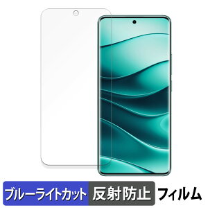 Xiaomi Redmi Note 14 Pro 5G / Redmi Note 14 Pro+ 5G یtB u[CgJbg tB y ȖʑΉ ˒ጸ z LYC {