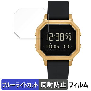 NIXON Siren / Siren SS �j�N�\�� �T�C���� �p �ی�t�B���� �u���[���C�g�J�b�g �t�B���� �y�ȖʑΉ� ���˒ጸ�z �L�Y�C�� ���{��