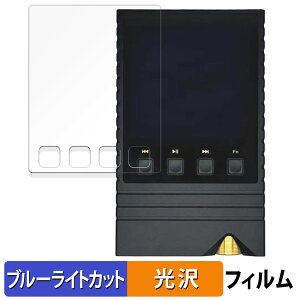 ONIX Overture XM5  یtB u[CgJbg tB yȖʑΉ dlz LYC {