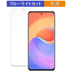ZTE S30 Pro ������ �ی�t�B���� �u���[���C�g�J�b�g �t�B���� �y�ȖʑΉ� ����d�l�z �L�Y�C�� ���{��
