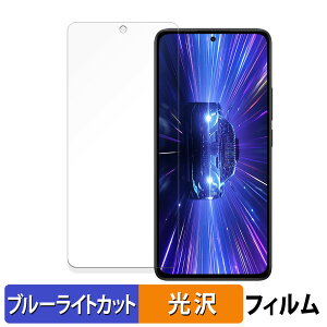 y|Cg2{z Xiaomi Redmi Note 14 4G  یtB u[CgJbg tB yȖʑΉ dlz LYC {