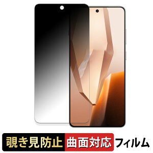 OnePlus Ace 5 ������ �y180�x �ȖʑΉ��z �`�����h�~ �t�B���� �u���[���C�g�J�b�g �A���`�O���A ���{��