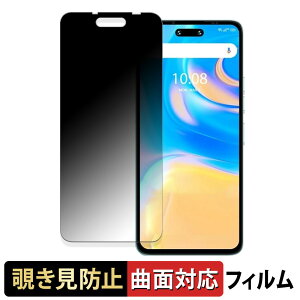 UMIDIGI G6 5G  y180x ȖʑΉz `h~ tB u[CgJbg A`OA {