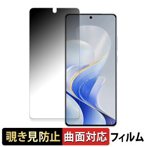 vivo S19  y180x ȖʑΉz `h~ tB u[CgJbg A`OA {