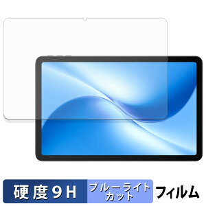 DOOGEE U12 یtB u[CgJbg tB y 9Hdx ˒ጸ z KXƓ̍dx {