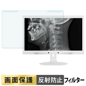 ���O���ȒP PHILIPS C271P4QPJEW/11 �u���[���C�g�J�b�g �t�B���^�[ �A���`�O���A �t���ی� �v���e�N�^�[