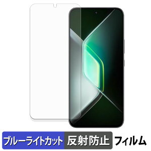 Infinix GT 30 Pro یtB u[CgJbg tB y ˒ጸ z {