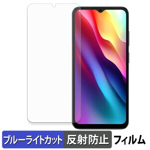 DOOGEE NOTE56 یtB u[CgJbg tB y ˒ጸ z {