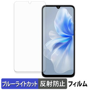 FOSSiBOT S2 �ی�t�B���� �u���[���C�g�J�b�g �t�B���� �y ���˒ጸ �z ���{��