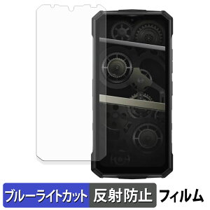 DOOGEE Fire 5 Ultra �ی�t�B���� �u���[���C�g�J�b�g �t�B���� �y ���˒ጸ �z ���{��