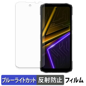 DOOGEE Blade20 Max �ی�t�B���� �u���[���C�g�J�b�g �t�B���� �y ���˒ጸ �z ���{��