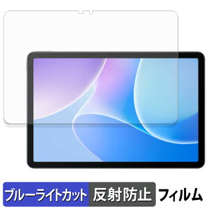 �y8/11 1:59�� �|�C���g2�{�z Infinix XPAD 20 �ی�t�B���� �u���[���C�g�J�b�g �t�B���� �y ���˒ጸ �z ���{��