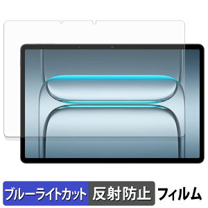 OnePlus Pad Lite یtB u[CgJbg tB y ˒ጸ z {