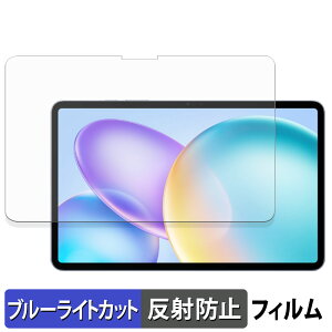 �y8/11 1:59�� �|�C���g2�{�z Infinix XPAD 20 Pro �ی�t�B���� �u���[���C�g�J�b�g �t�B���� �y ���˒ጸ �z ���{��