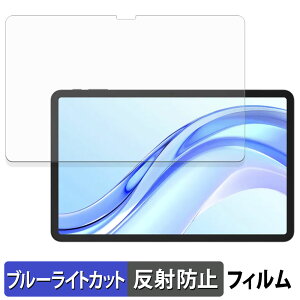 DOOGEE Tab E3+ �ی�t�B���� �u���[���C�g�J�b�g �t�B���� �y ���˒ጸ �z ���{��