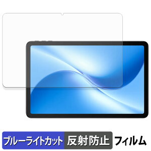 y|Cg2{z DOOGEE U12 یtB u[CgJbg tB y ˒ጸ z {