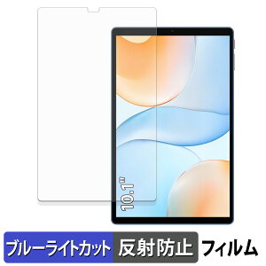 ALLDOCUBE iPlay 70 یtB u[CgJbg tB y ˒ጸ z {