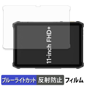 Ulefone Armor Pad 5 Ultra / Pro �ی�t�B���� �u���[���C�g�J�b�g �t�B���� �y ���˒ጸ �z ���{��
