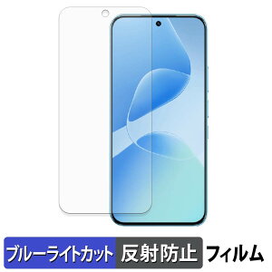 Infinix HOT 60 Pro �ی�t�B���� �u���[���C�g�J�b�g �t�B���� �y ���˒ጸ �z ���{��