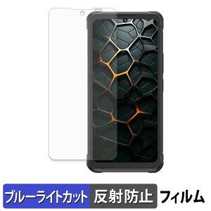 CUBOT KingKong Ace 5 �ی�t�B���� �u���[���C�g�J�b�g �t�B���� �y ���˒ጸ �z ���{��