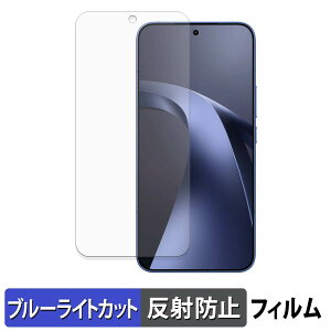 Xiaomi 17T Pro �ی�t�B���� �u���[���C�g�J�b�g �t�B���� �y ���˒ጸ �z ���{��