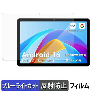 PHILIPS T7315X �ی�t�B���� �u���[���C�g�J�b�g �t�B���� �y ���˒ጸ �z ���{��